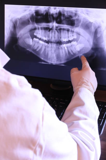 Best Emergency Broken Tooth Repair in Lower Burrell, PA